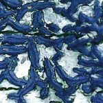 Arthonia atra - Close up