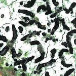 Opegrapha niveoatra - Close up 1